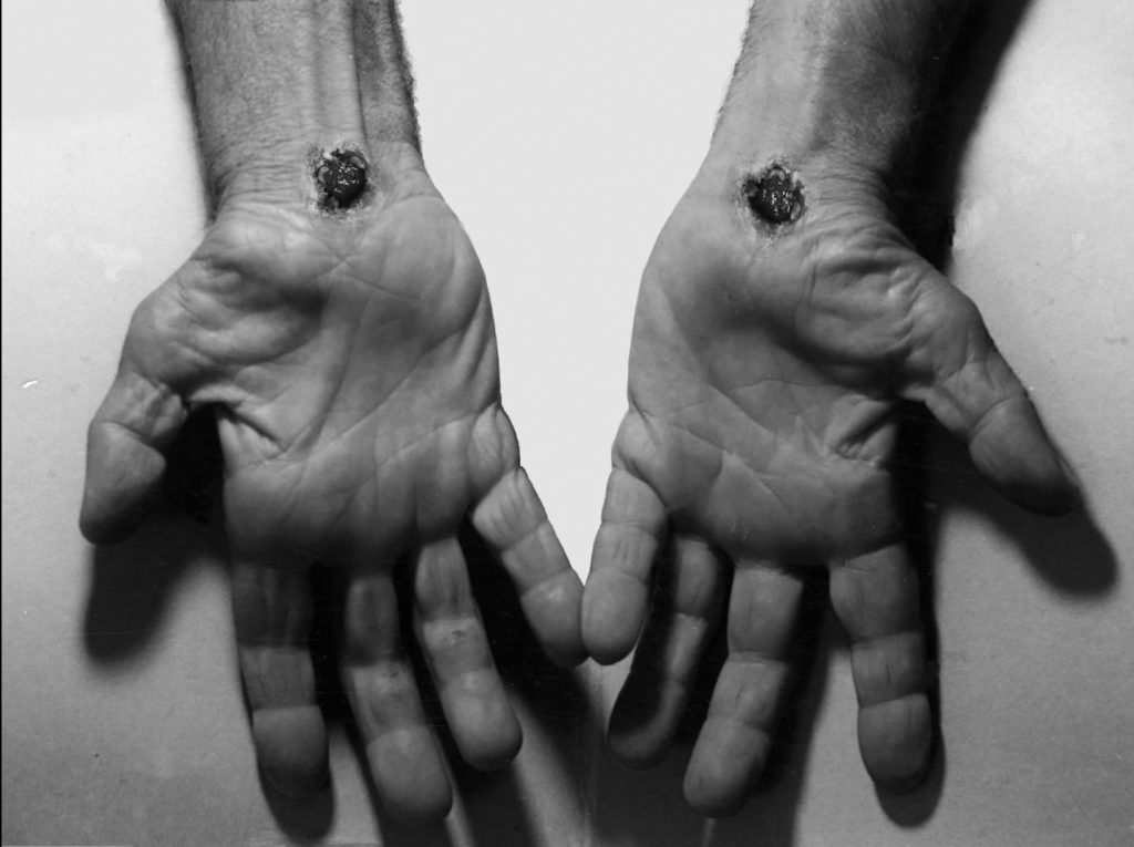 scarred hands